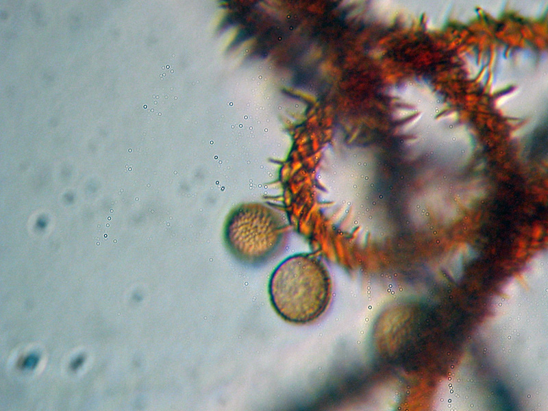 Metatrichia vesparium ?